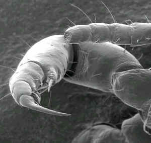 Head_lice